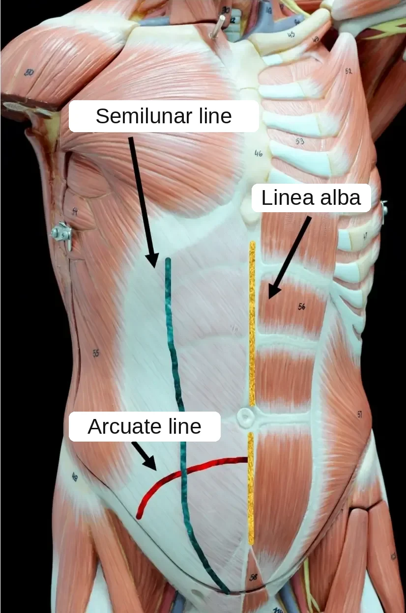 Anatomical model of the abdominal wall with the linea alba, the semilunar line and the arcuate line marked on the muscles
