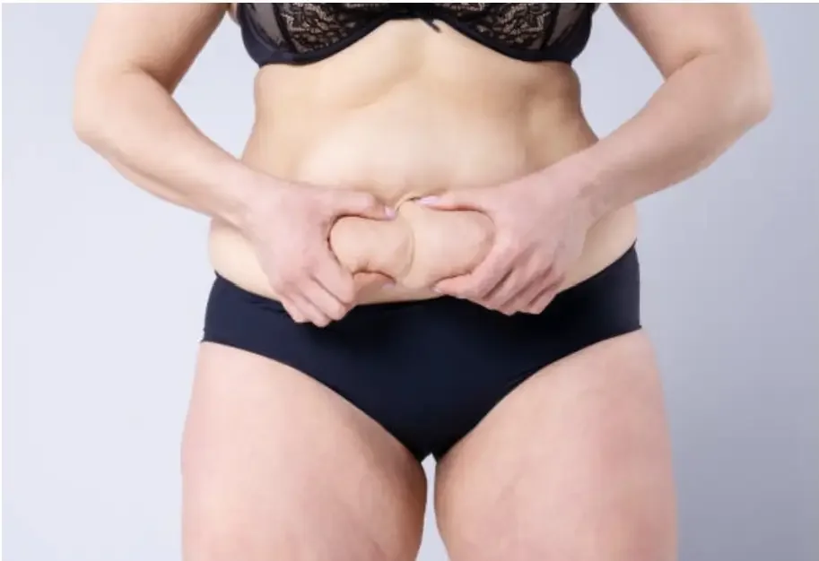 Woman after childbirth lifting the loose skin of the abdomen around the navel with her hands
