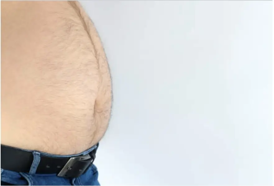 Diastasis recti in a man with a widened midline