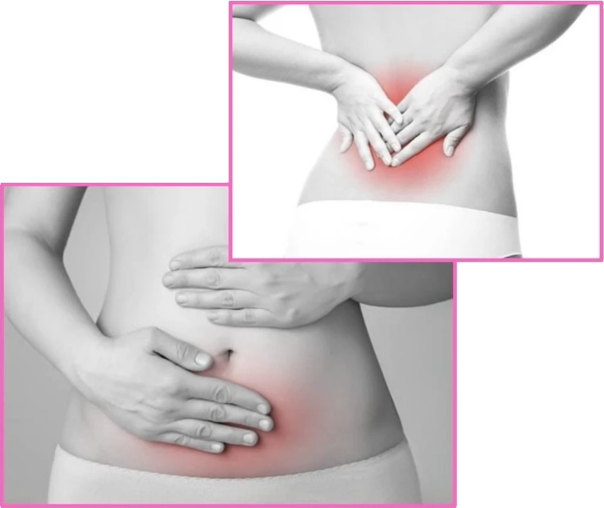 Overview of the main symptoms of diastasis recti
